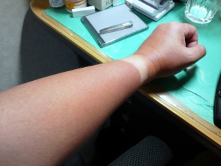 腕時計の跡w 腕時計の跡w