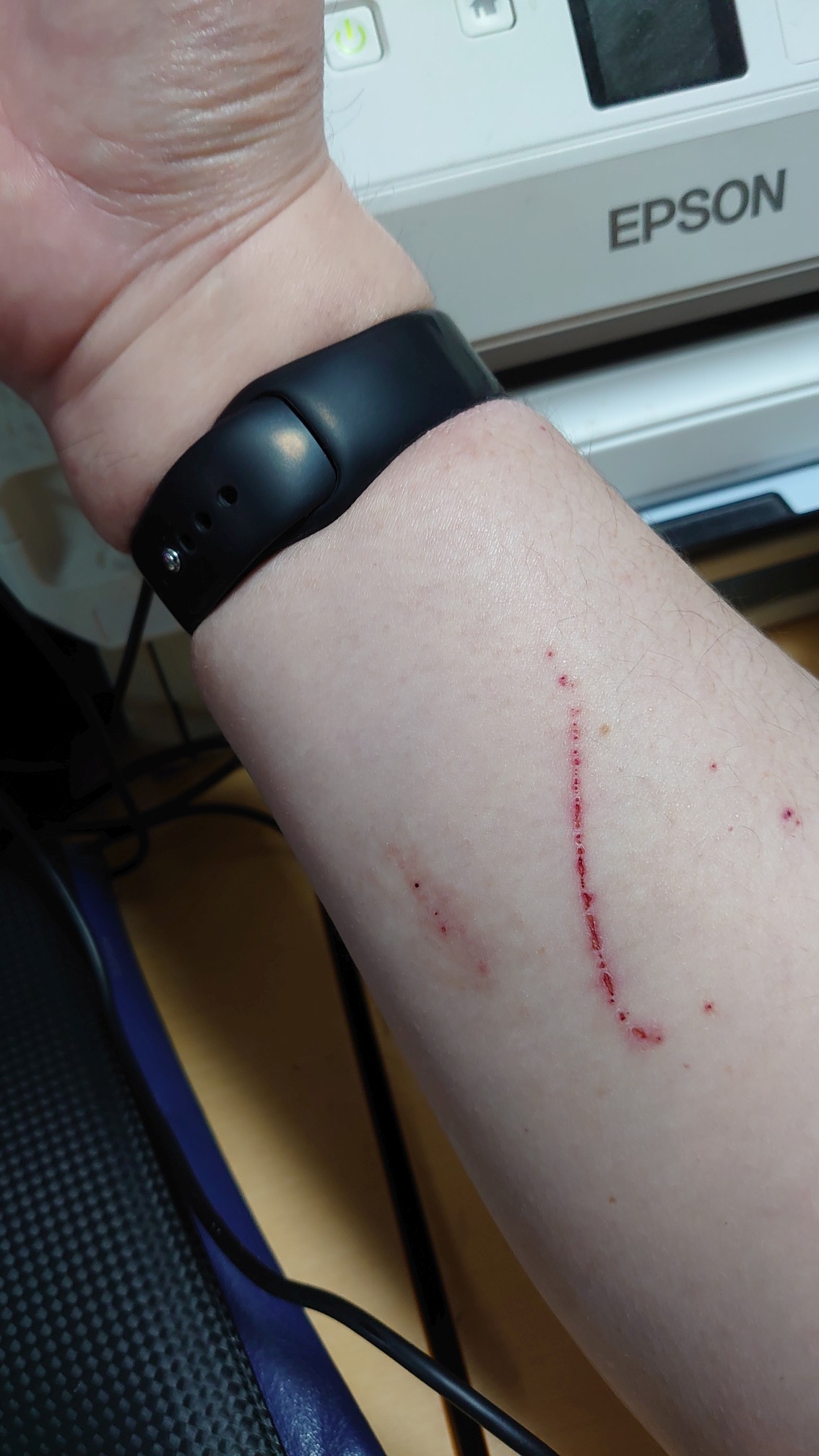 キズがw キズがw